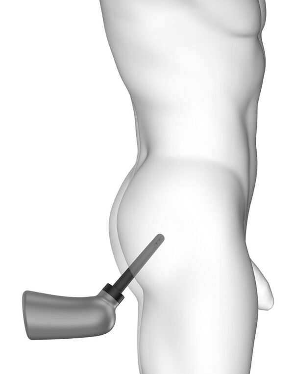 Douche anal pear - Imagen 2