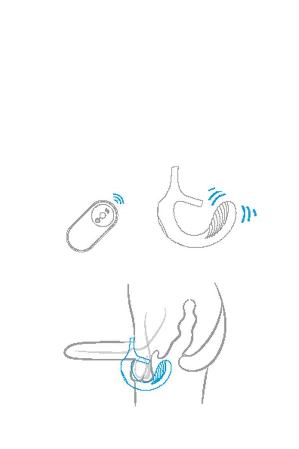 Remote couples teaser - Imagen 5